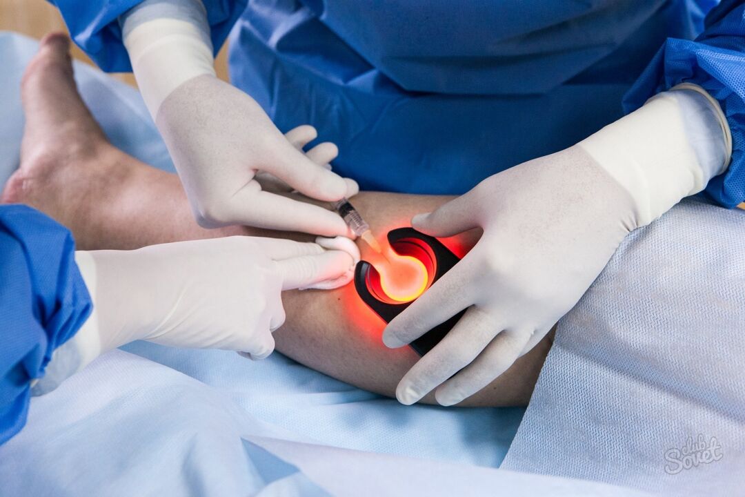 Varicose veins in the diagnoses of the legs