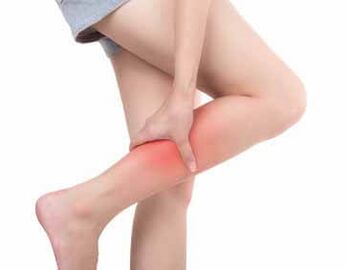 Varicose veins symptoms
