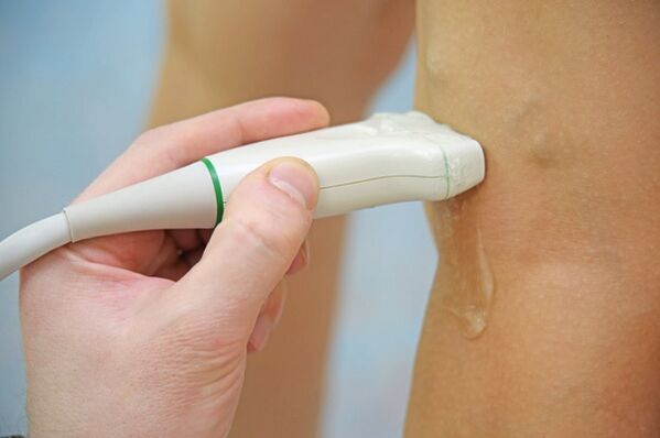 Vein ultrasound