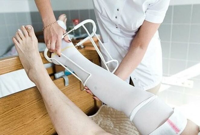 Post -Operative Period of Surgery in the veins of the legs